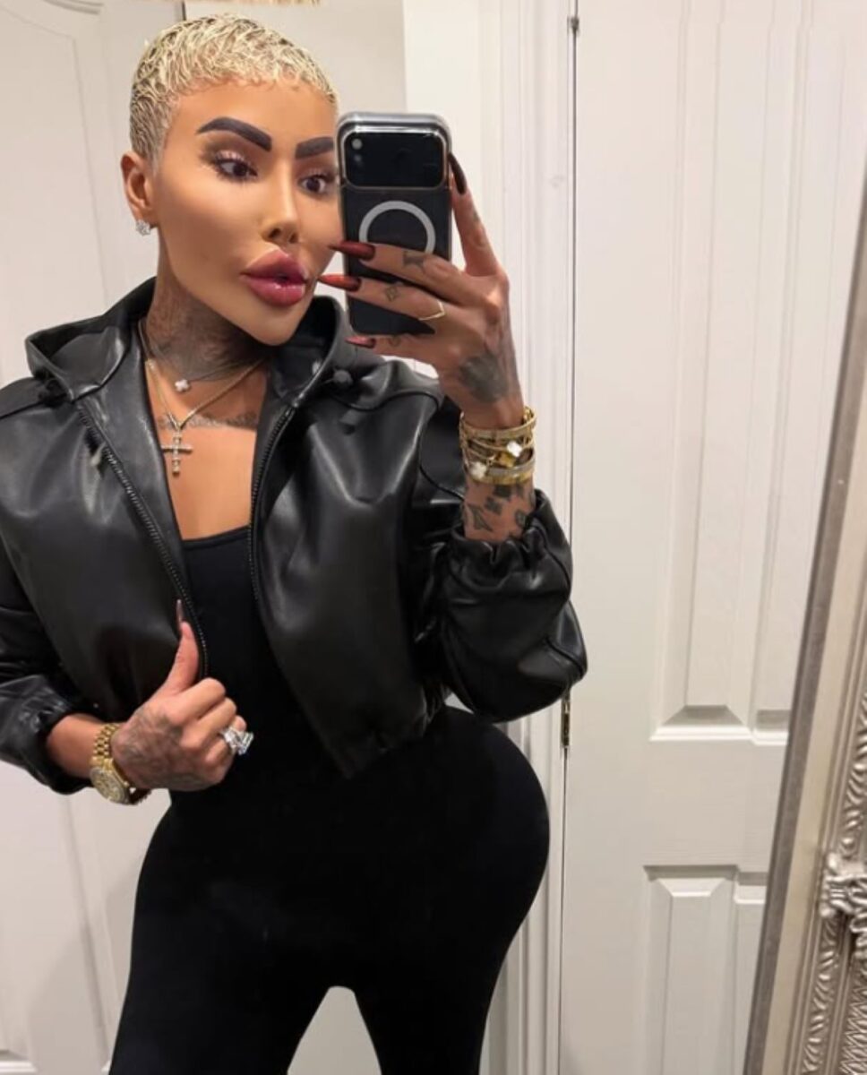 "Lip King" nie żyje, miał 34-lata. Wydał 150 tys. dolarów, żeby wyglądać jak Kardashian