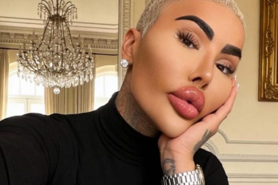 "Lip King" nie żyje, miał 34-lata. Wydał 150 tys. dolarów, żeby wyglądać jak Kardashian
