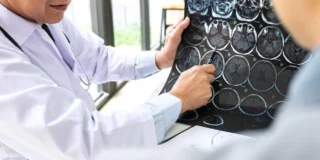 Skan całego ciała za 299 funtów Foto: lekarz oglądający wyniki badań